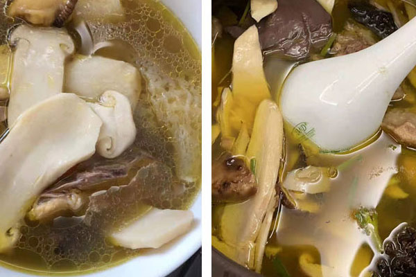 子宮肌瘤可以吃松茸嗎 子宮肌瘤可以吃松茸嗎